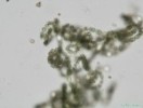 247. Anabaena sp.
bn druh planktonu eutrofnch vod
Autor: Petr Haler
Kategorie: Algologie