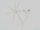 253. Asterionella formosa
bn planktonn rozsivka, zejmna na podzim, napravo zbytky loriky Dinobryon divergens
Autor: Petr Haler
Kategorie: Algologie