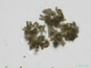 251. Microcystis viridis
eutrofn ndre, soust vodnch kvt
Autor: Petr Haler
Kategorie: Algologie