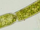 246. Oedogonium sp.
lmeky-detail
Autor: Petr Haler
Kategorie: Algologie