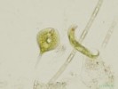 249. Phacus sp. et Euglena sp.
bn druhy planktonu eutrofnch vod, lokalita-Lnice,rybnky
Autor: Petr Haler
Kategorie: Algologie