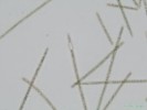 248. Planktothrix agardhii
bn druh planktonu eutrofnch vod,tvo vodn kvty, lokalita-Arboretum Bl Lhota
Autor: Petr Haler
Kategorie: Algologie